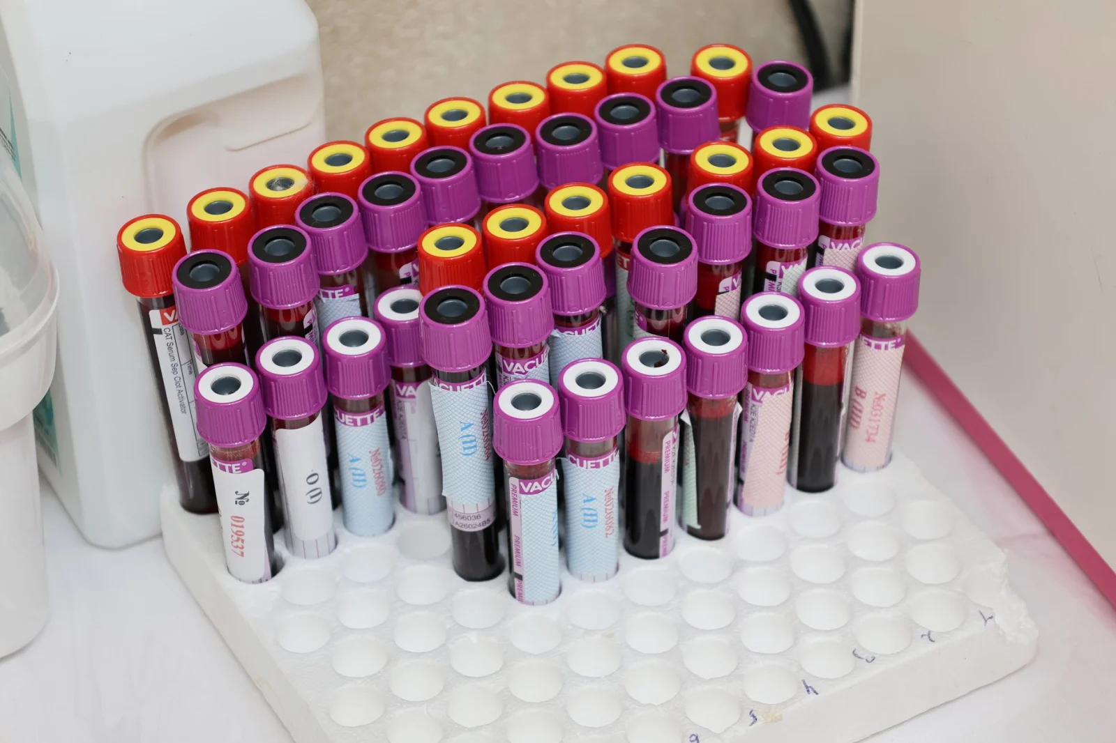 New Data on Blood Inflammation: Three Metrics You Should Know